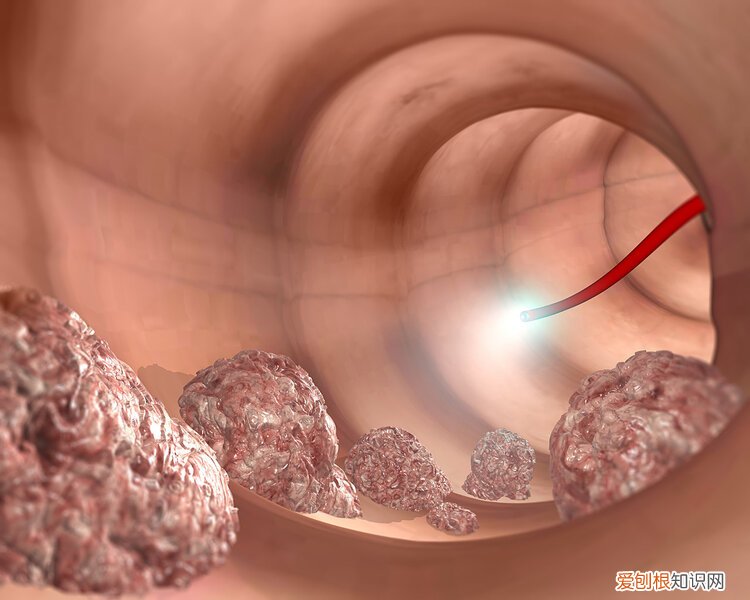 听说做肠镜很痛苦 肠镜为什么尽量不要做
