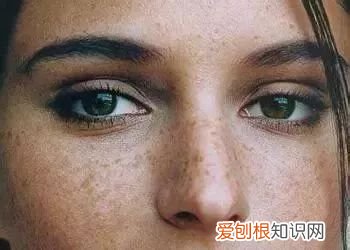 脸上长斑是什么? 佛说女人脸上长斑因果