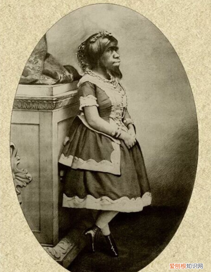 一生被当成摇钱树,死后被制成标本 世界上最丑的女孩