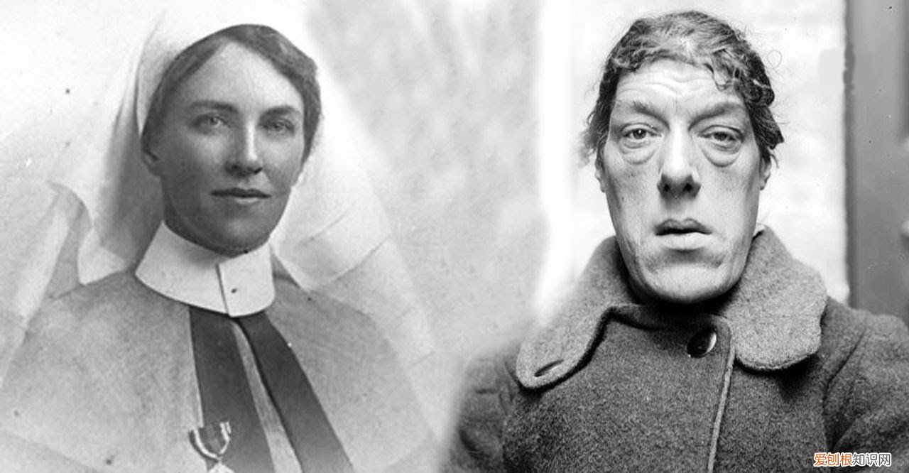 年轻时照片令人感慨 世界上最丑的女人