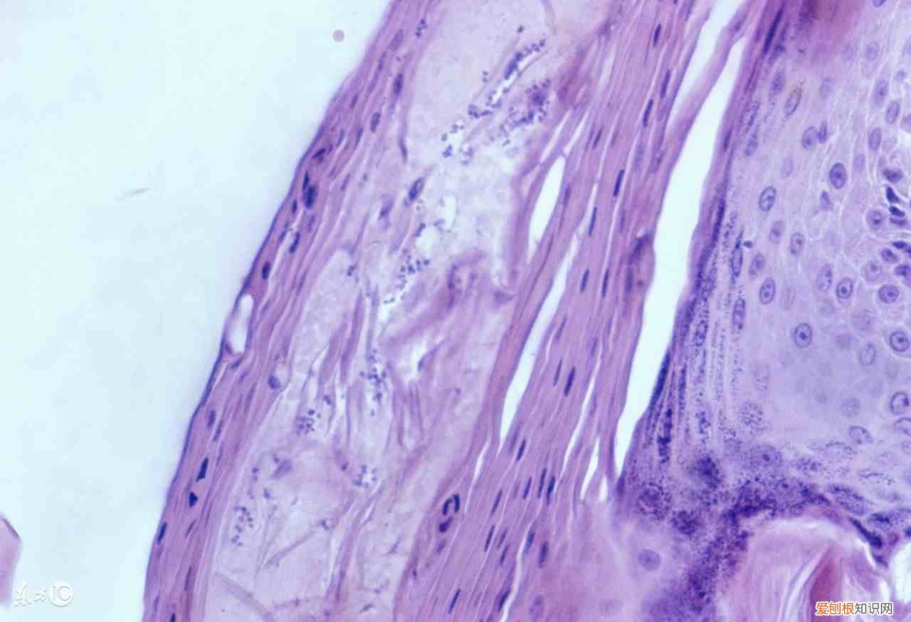 目前治疗毛囊炎都有哪些有效的药物 毛囊炎用什么药最有效