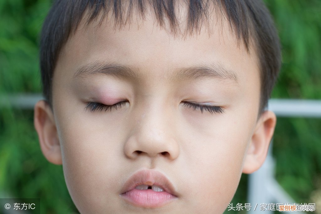 麦粒肿是什么原因引起？这4个原因，可以很好解释