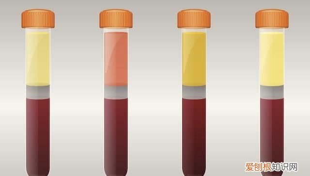 三个危害，早发现及时就医 总胆红素偏高说明什么