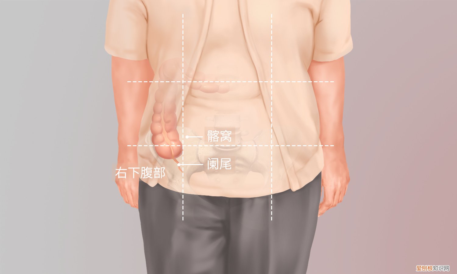 阑尾在哪个位置？阑尾的五种常见位置