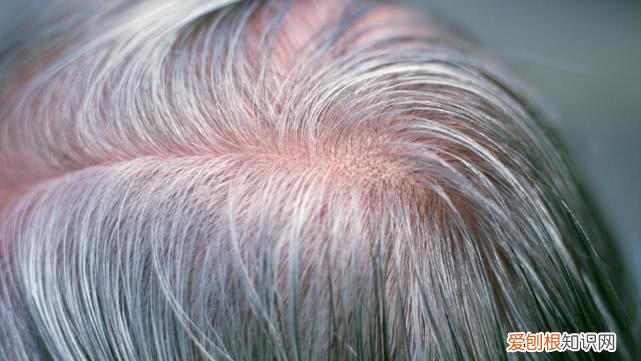 一夜白头是真的吗？压力过大会导致头发快速变白