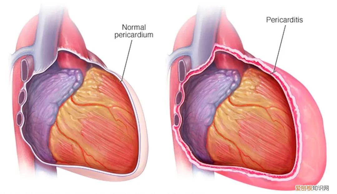 胸部痛疼是什么原因？引起胸痛常见的12种原因