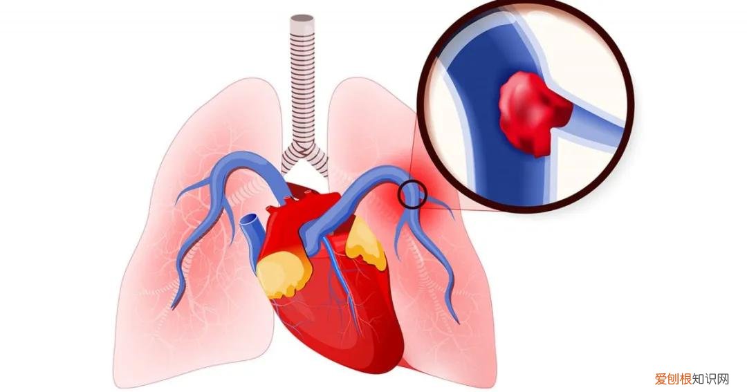 胸部痛疼是什么原因？引起胸痛常见的12种原因