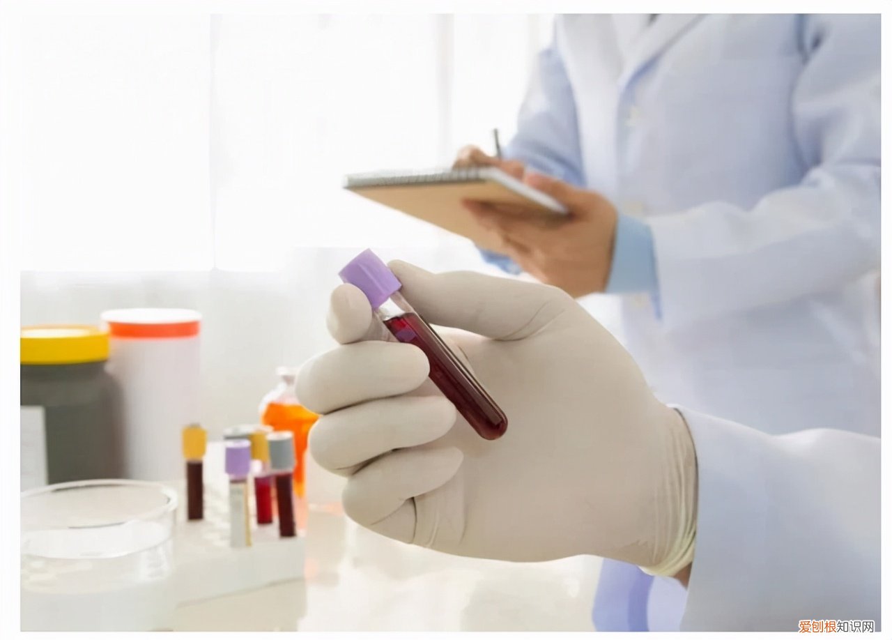 淋巴细胞百分比偏高一点点要紧吗？看看专家怎么说