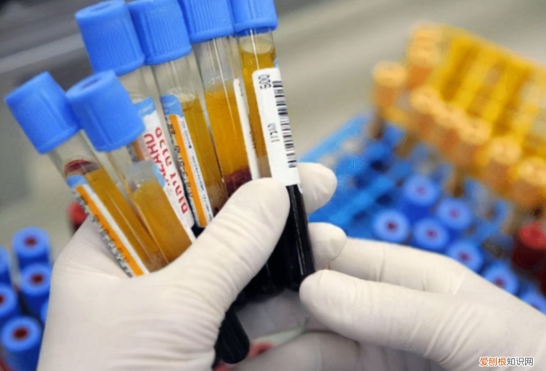 淋巴细胞百分比偏高一点点要紧吗？看看专家怎么说