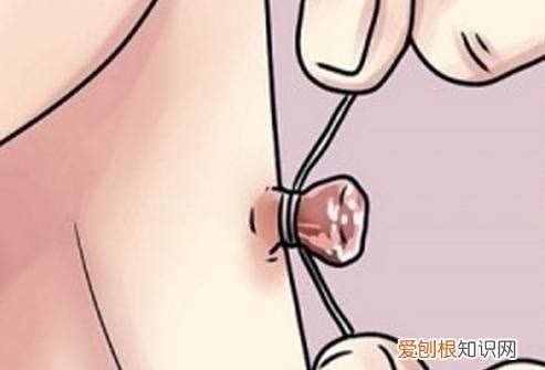 直接揪掉吗?建议了解下 腋下长了一个小疙瘩是什么东西