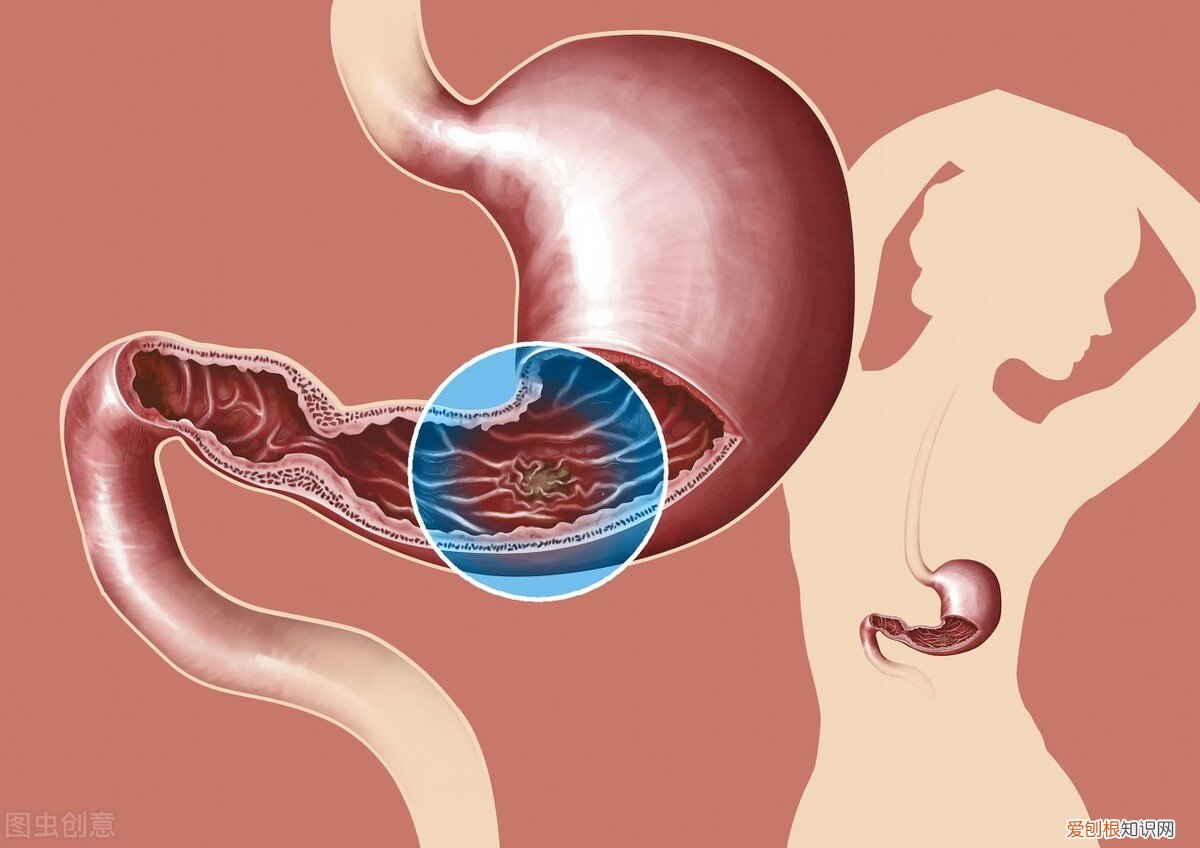 屁特别多是什么原因？屁多可能是4大原因所致