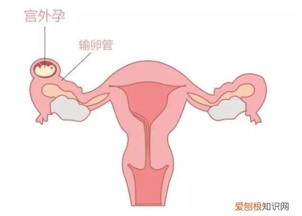 有可能是这几个原因导致 验孕棒一深一浅是怀孕了吗