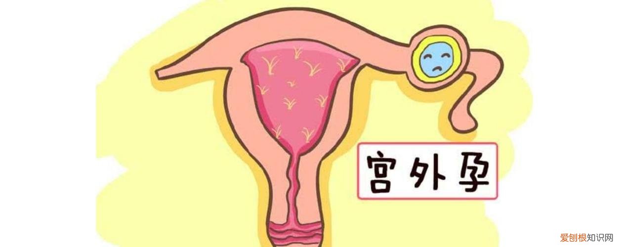 取环什么时候取最好？来听听专家怎么说