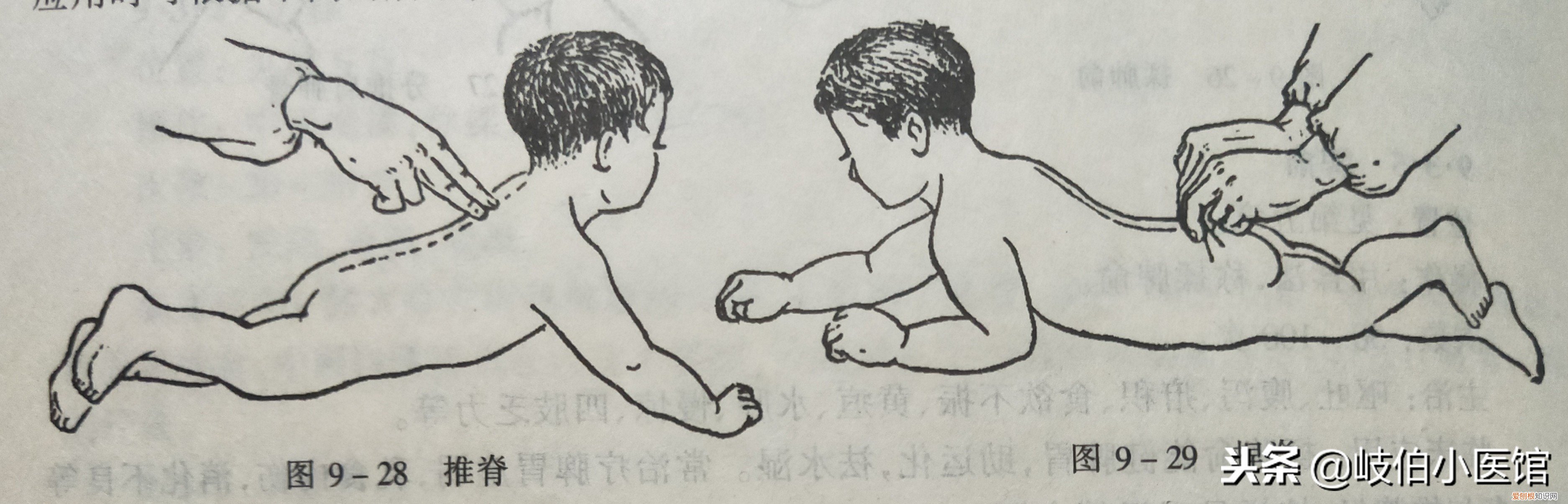 附操作详解图示 发烧怎么降温最快物理方法