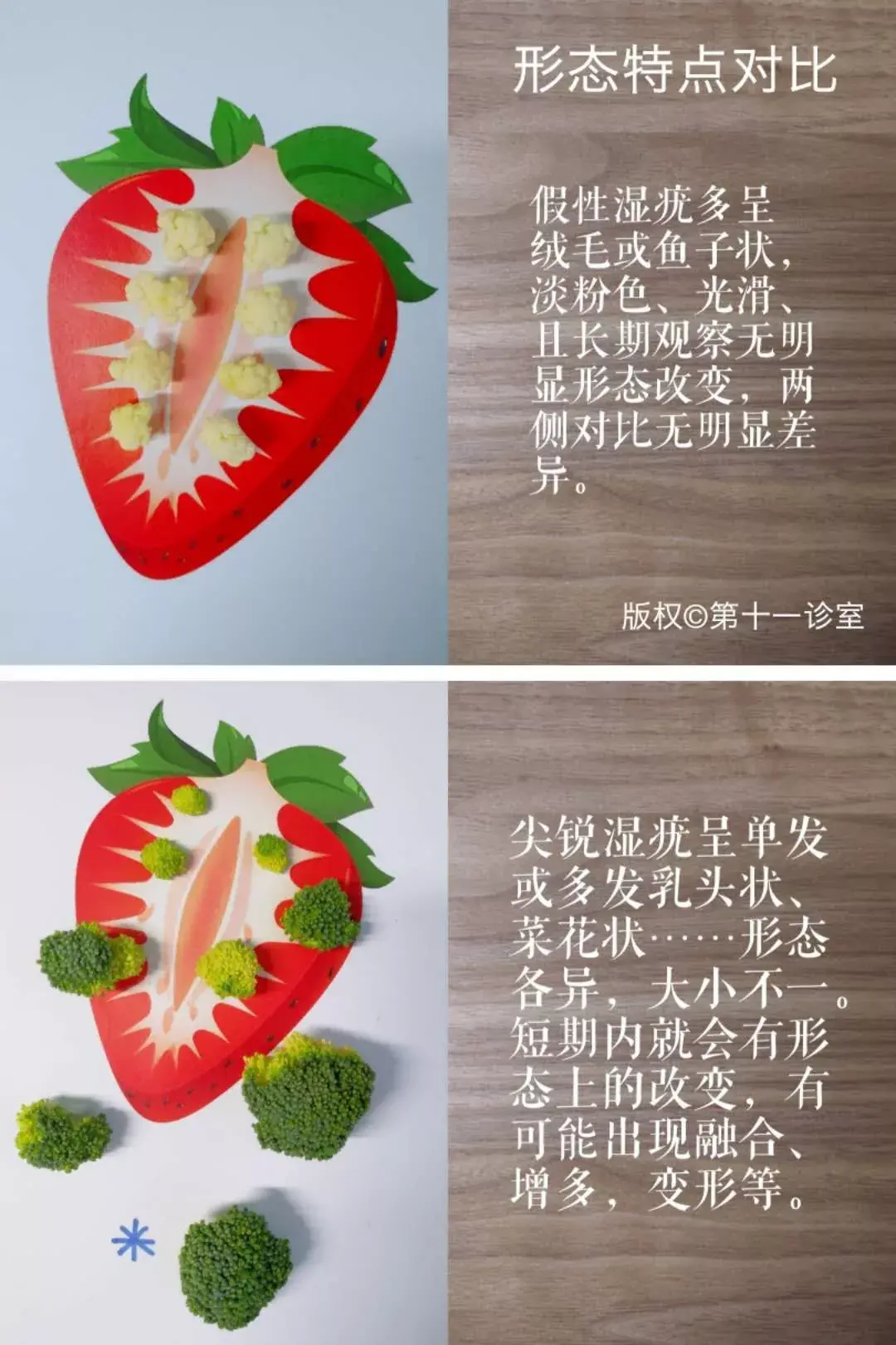 尖锐湿疣是什么样的,尖锐湿疣图片真实