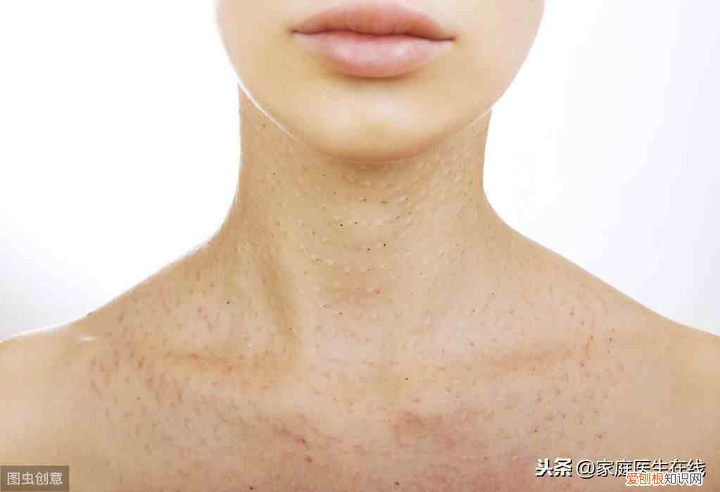 脖子上容易长疙瘩是怎么回事 脖子上长痘痘什么原因