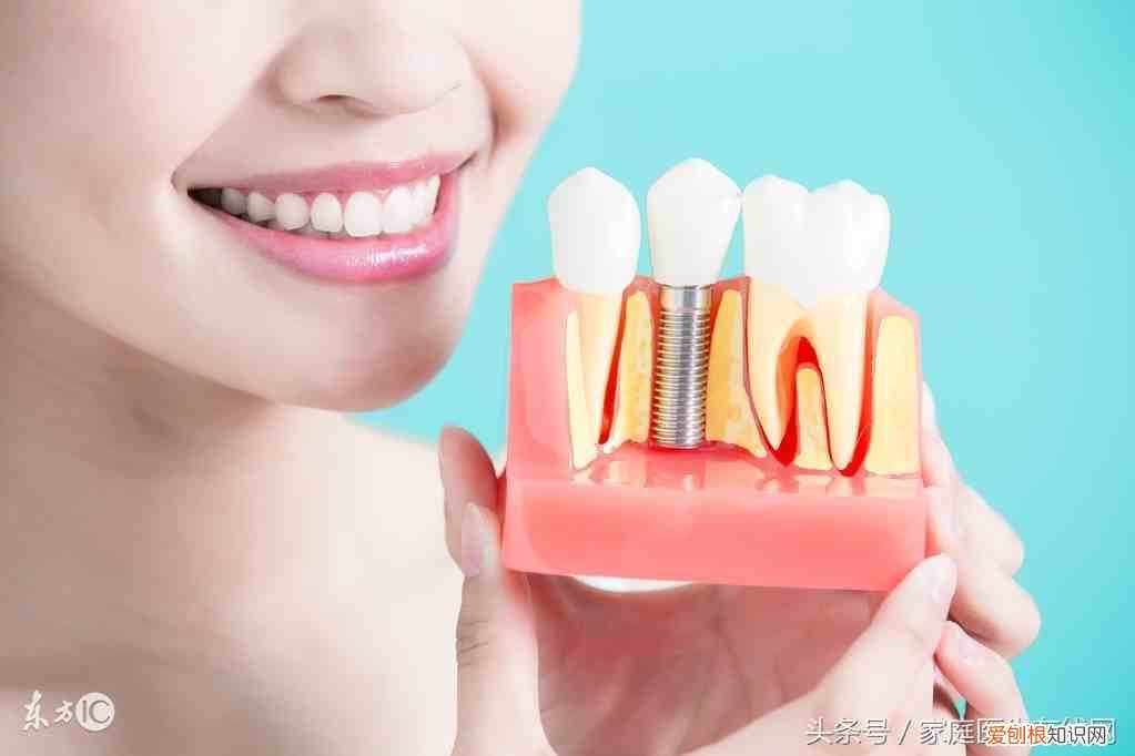 种植牙能用一辈子吗? 种植牙多少钱一颗