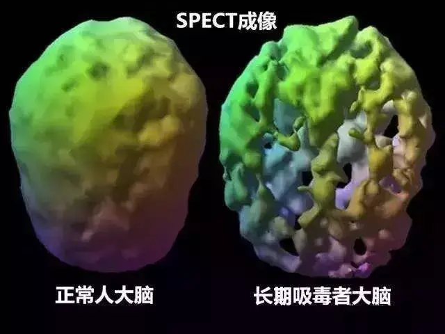 吸毒产生幻觉是什么毒品 吸毒为什么幻觉