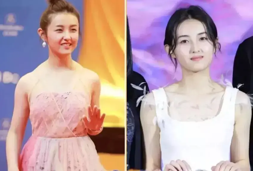 消除斜方肌最快的方法张子枫 消除斜方肌最快的方法