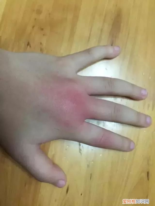 下雨有虫飞进来怎么处理