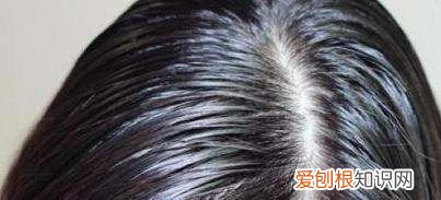 头发总是爱出油是什么原因，天生头发油有什么办法可以改善
