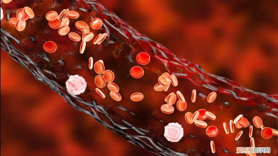 软化血管的5大误区您知道几个？提醒：延缓血管硬化需注意4点