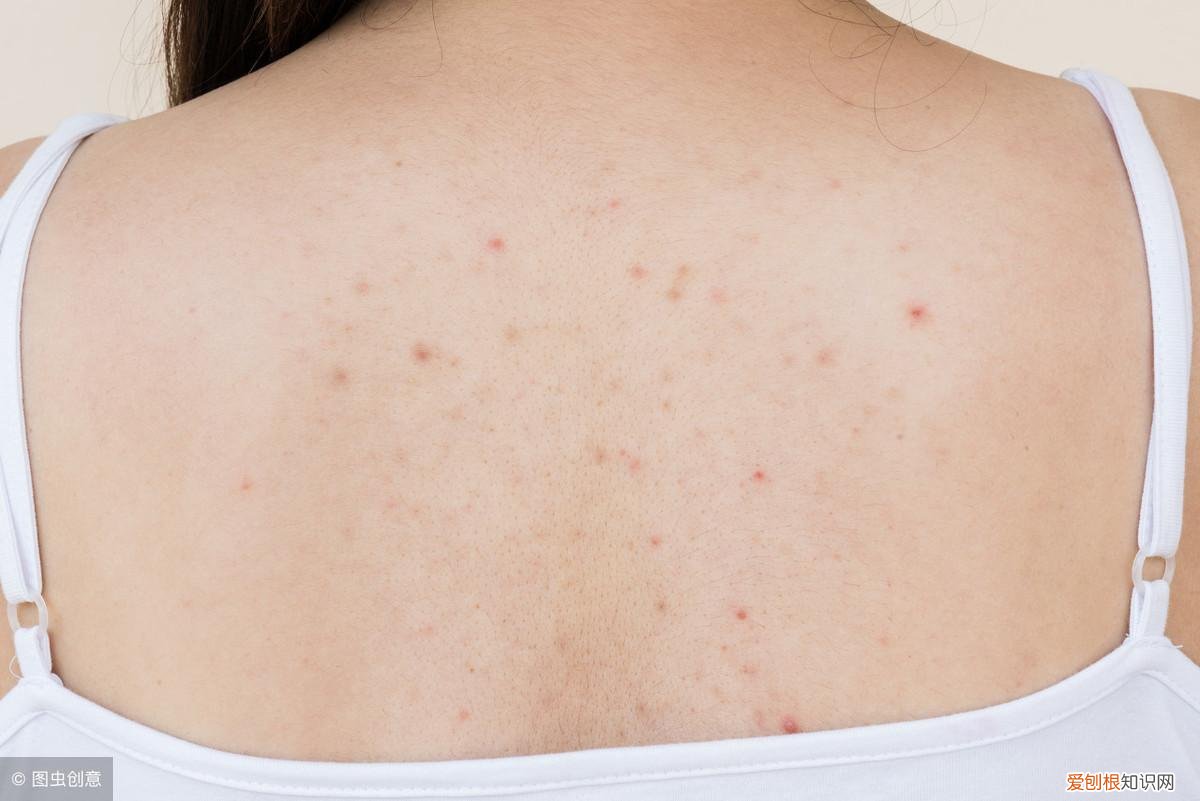 这样吃可有效调理 背上长痘痘的原因为什么背上长痘