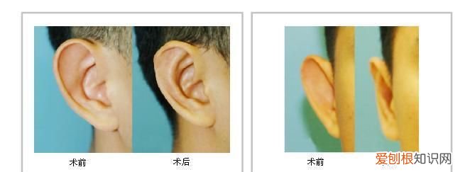解读女人精灵耳和招风耳的区别 解读女人精灵耳和招风耳的不同