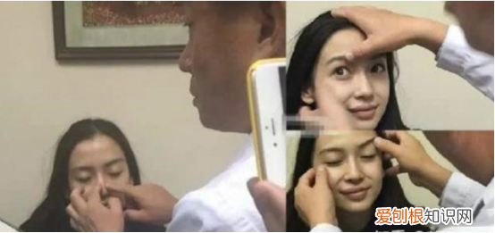 杨颖整容了吗,杨颖整容前照片对比