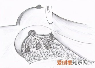 选择40岁以上女性检查项目：定位活检