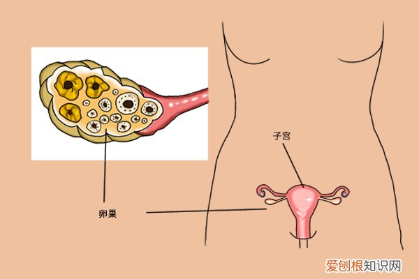 为什么卵巢癌是晚期发现的？抗癌协会会员：仅仅因为忽略了三个信号