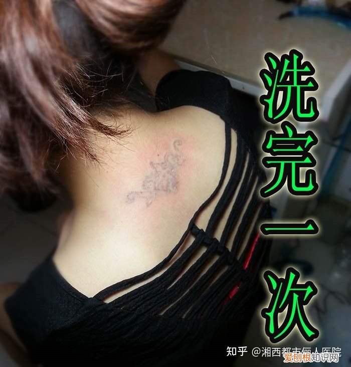 去医院洗纹身价格 哪里洗纹身好