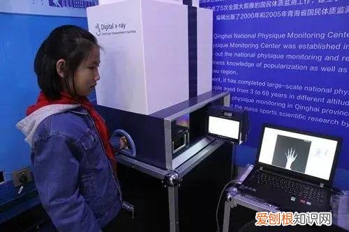 骨龄是什么意思 骨龄司法鉴定是什么