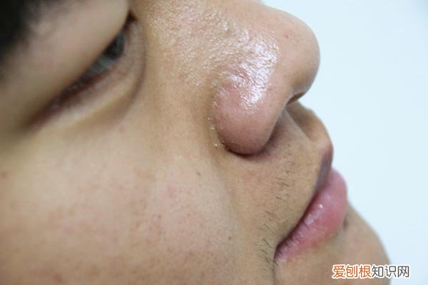 额头、鼻尖、胸部和背部出汗是什么意思