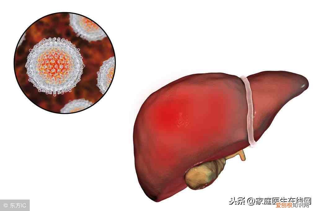 感染上肝炎会有什么表现 肝炎的症状有哪些