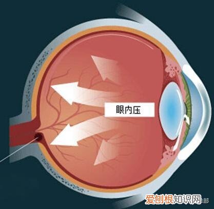 高度近视的人不适合做什么？