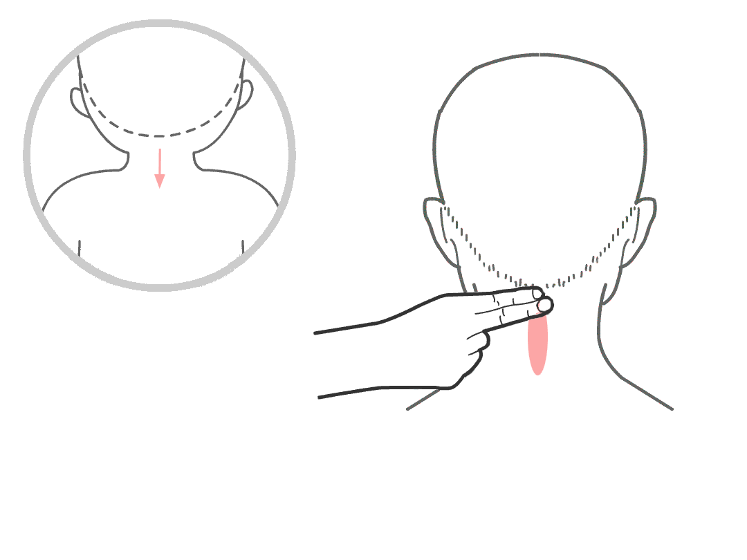 小儿高热退烧推拿手法 小儿高烧39度推拿手法图解