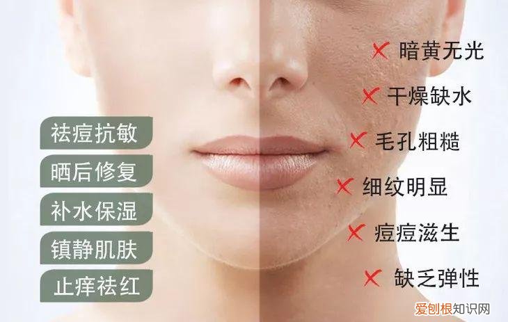 每天晚上坚持涂芦荟胶的效果 芦荟胶对痘痘和痘印有效果吗