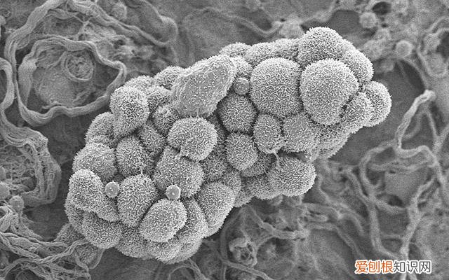 该来例假了可是光疼就不来呢