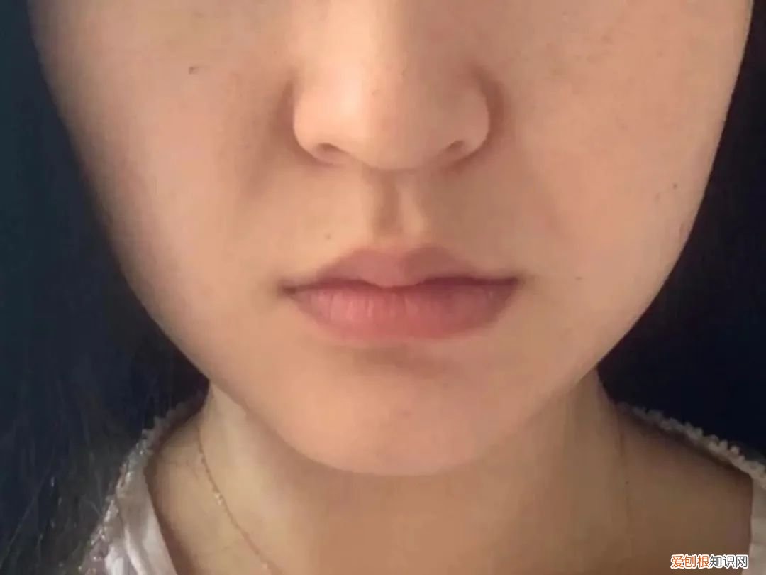 不同类型的法令纹应该如何消除 法令纹怎么消除