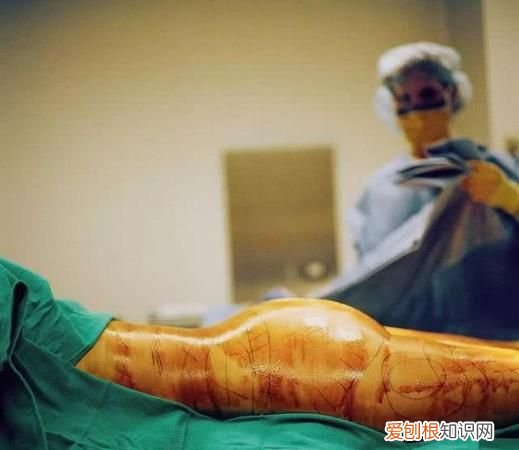 抽脂有哪些危害呢，抽脂减肥有害身体 盘点抽脂减肥的危害