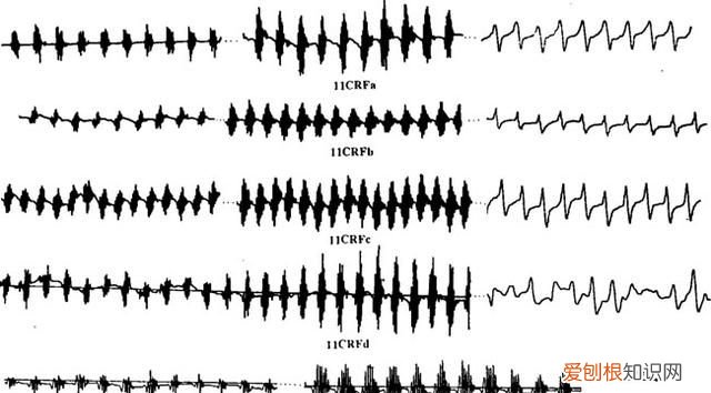 关于抓知了的事儿