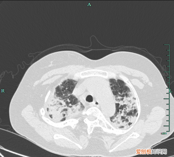 种植灵芝吃了有用吗