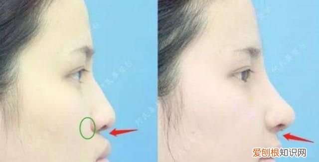 欧阳娜娜的鼻子是塌鼻子吗,欧阳娜娜鼻子侧脸