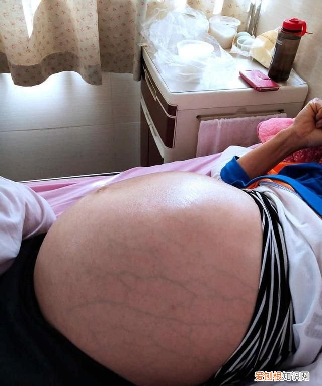 骨瘦如柴肚子隆起很大是什么癌症