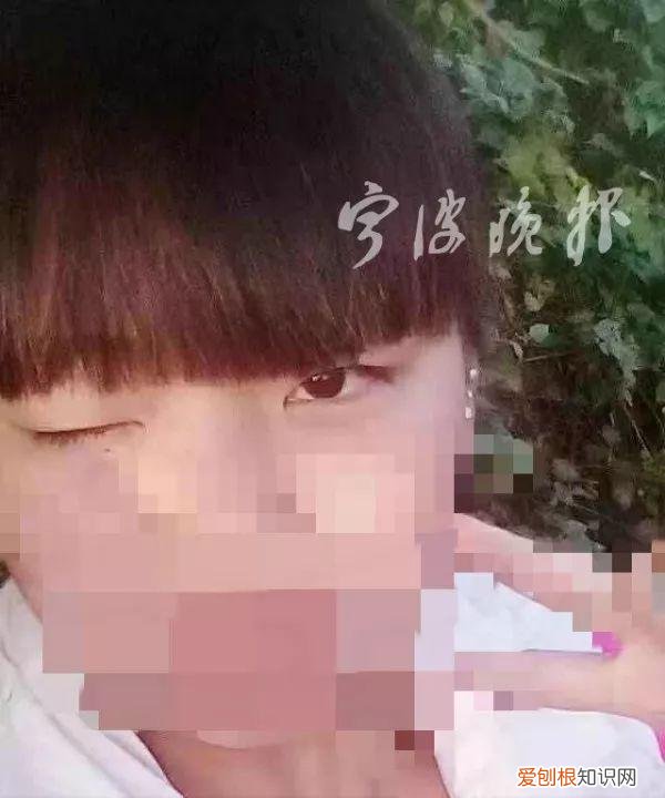 济南割双眼皮最好的医院