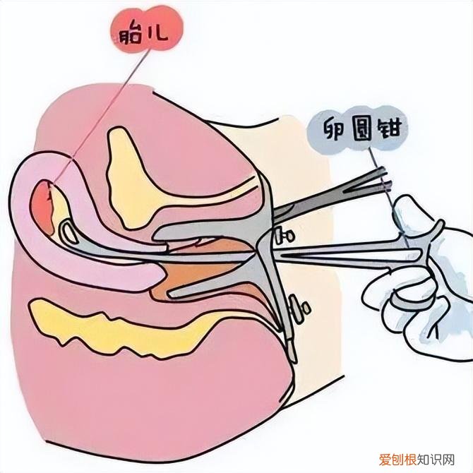流产最佳时间是多少天到多少天