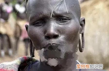 唇盘族割嘴唇全过程