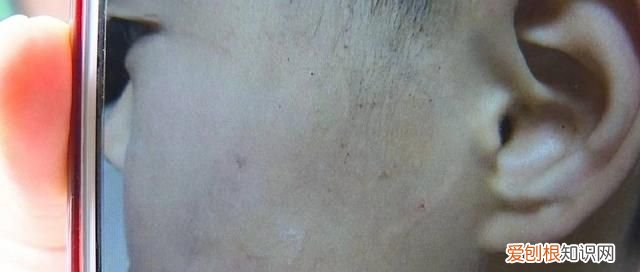 教师泼开水事件,安徽一小学生遭老师泼开水