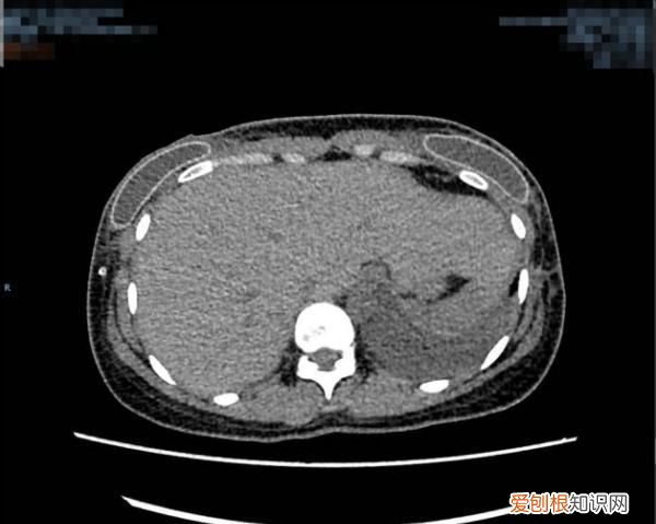 怀孕罩杯可能从a到d么